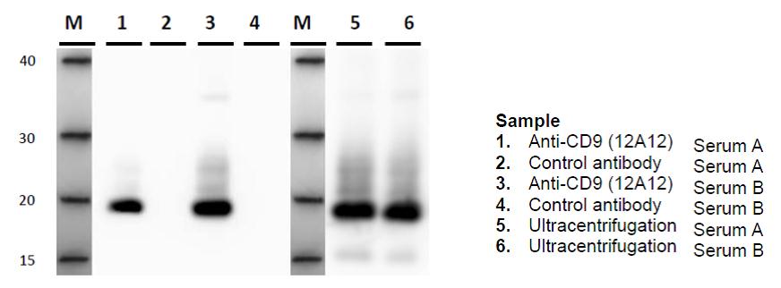IP-WB exosomes in serum sample with anti-CD9 antibody (12A12)