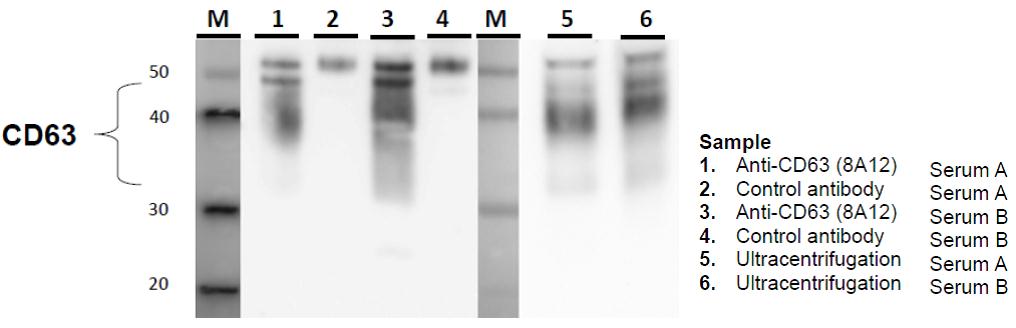 IP-WB exosomes in serum sample with anti-CD63 antibody (8A12)