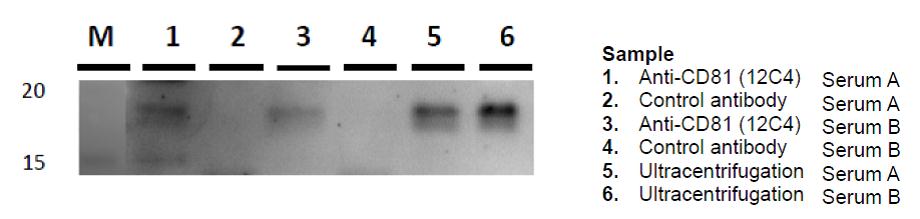 IP-WB exosomes in serum sample with anti-CD81 antibody (12C4)