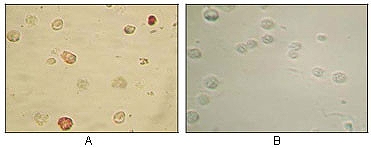 AO1016A