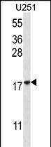 AP13157A-EV
