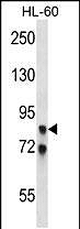 AP14462A