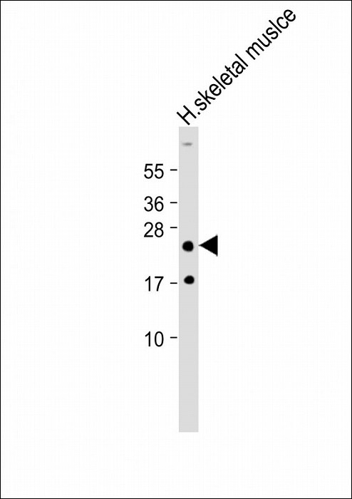 AP22280C