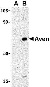 ASC10136