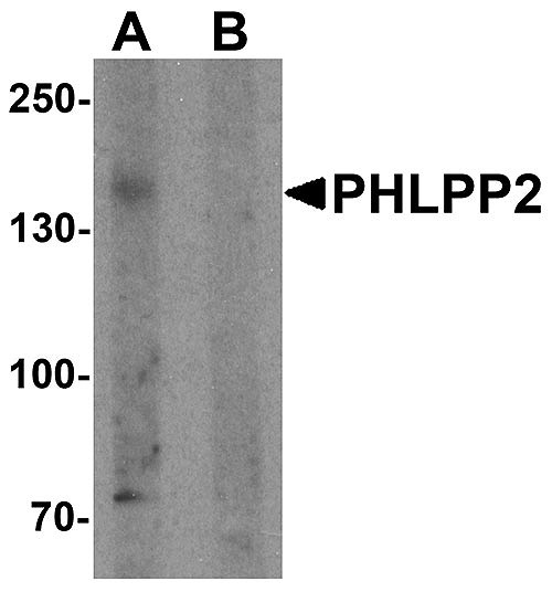 ASC11541