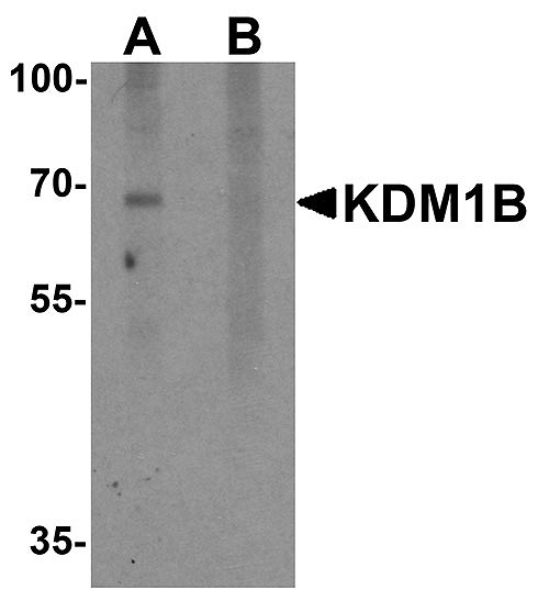 ASC11718