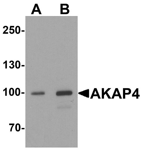 ASC11850