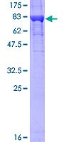 KPNA2（ABV-H00003838P01-25UG）（カテゴリ：タンパク質、糖類