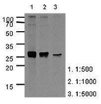 ATGA0215