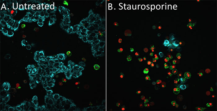 Nucview 530 Caspase 3 Substrate 1 Mm In Dmso Bti 100ul 1 Mm In Dmso カテゴリ 定量 検出キット 商品情報 コスモ バイオ株式会社