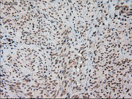パラフィン包埋子宮内膜をHES1抗体（品番TA500114）でIHC染色