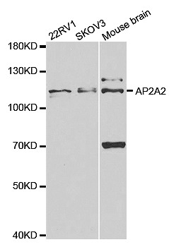 STJ27344
