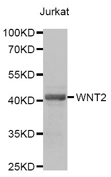 STJ28427