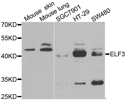 STJ28454