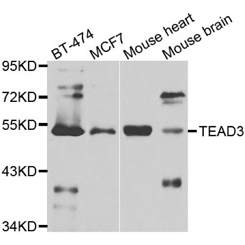 STJ29590