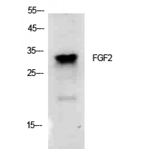 STJ97244