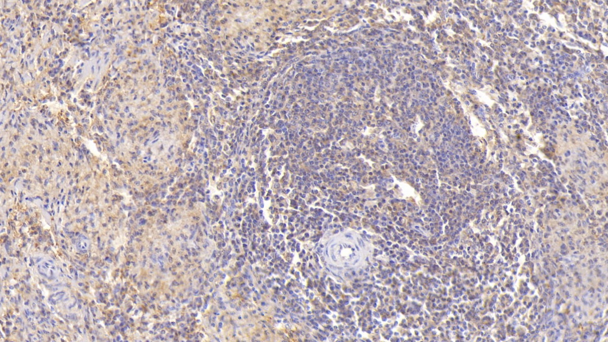 MAB461HU21