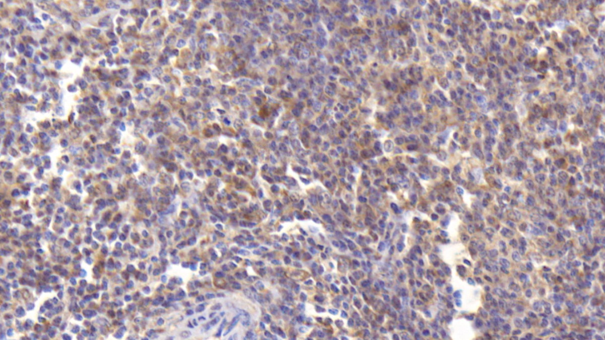 MAB461HU23