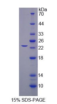 Splicing Factor 3B Subunit 3 (SF3B3)（WLS-RPM216MU01-1MG